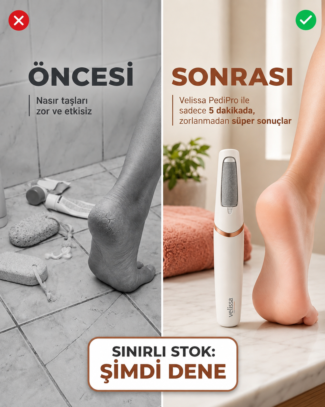 Luvendio PediPro Elektrikli Topuk & Ayak Bakım Cihazı
