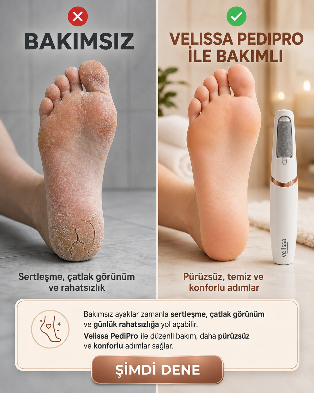 Luvendio PediPro Elektrikli Topuk & Ayak Bakım Cihazı